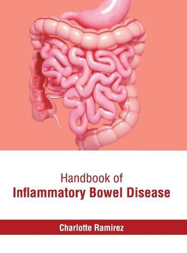 Cover image for Handbook of Inflammatory Bowel Disease