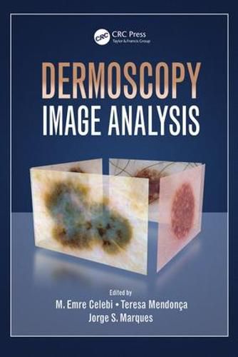 Cover image for Dermoscopy Image Analysis