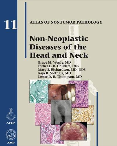 Non-Neoplastic Diseases of the Head and Neck