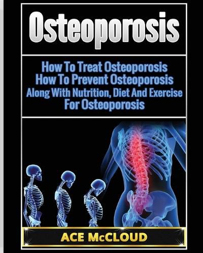 Cover image for Osteoporosis: How To Treat Osteoporosis: How To Prevent Osteoporosis: Along With Nutrition, Diet And Exercise For Osteoporosis