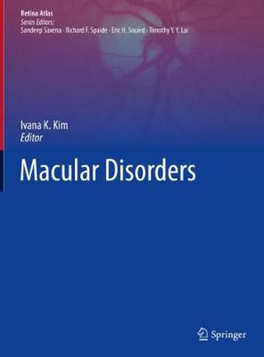 Cover image for Macular Disorders