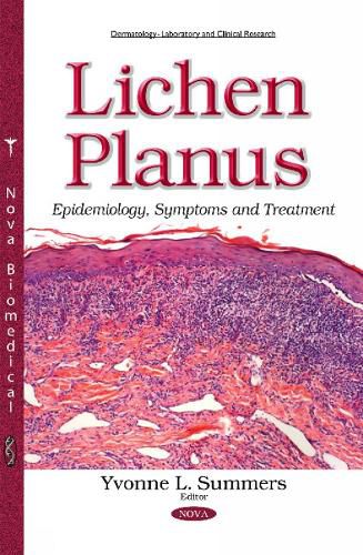 Cover image for Lichen Planus: Epidemiology, Symptoms & Treatment