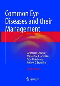 Cover image for Common Eye Diseases and their Management