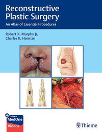 Cover image for Reconstructive Plastic Surgery: An Atlas of Essential Procedures