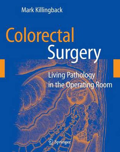 Cover image for Colorectal Surgery: Living Pathology in the Operating Room