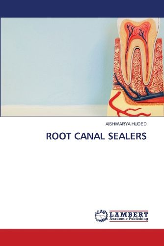 Cover image for Root Canal Sealers
