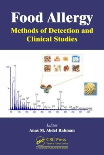 Cover image for Food Allergy: Methods of Detection and Clinical Studies