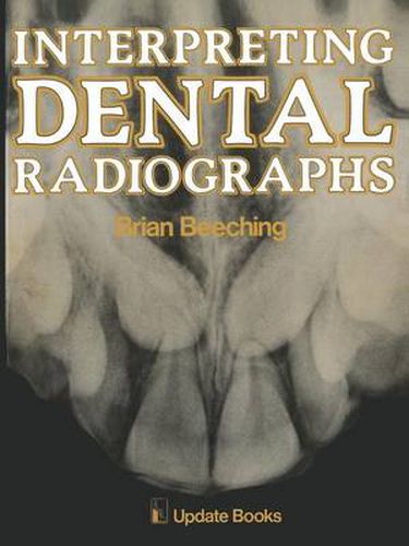Cover image for Interpreting Dental Radiographs