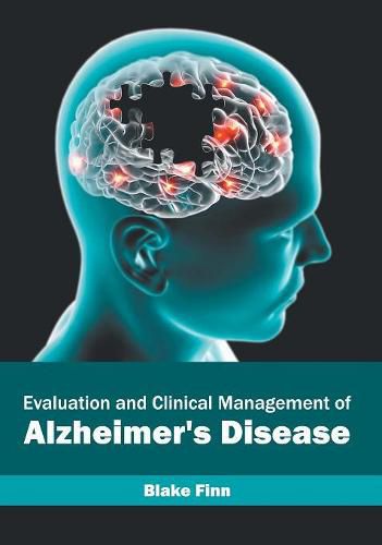 Cover image for Evaluation and Clinical Management of Alzheimer's Disease