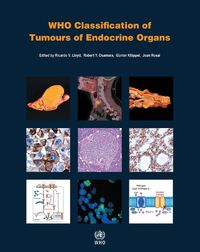 Cover image for WHO classification of tumours of endocrine organs