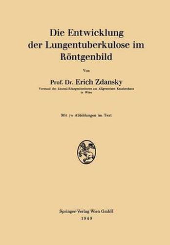 Cover image for Die Entwicklung Der Lungentuberkulose Im Roentgenbild