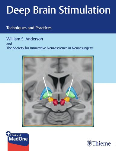 Cover image for Deep Brain Stimulation: Techniques and Practices