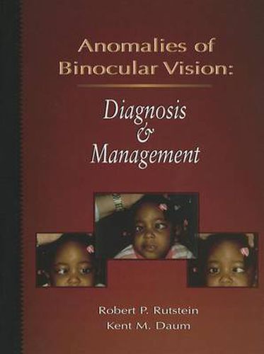 Cover image for Anomalies Of Binocular Vision: Diagnosis And Management