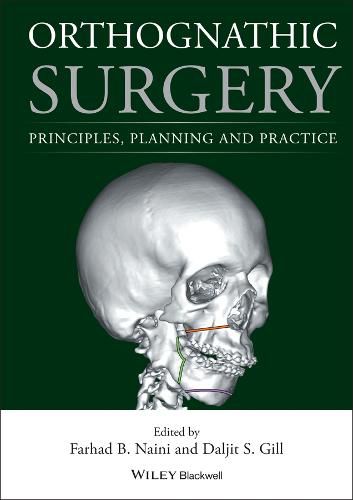 Cover image for Orthognathic Surgery - Principles, Planning and Practice