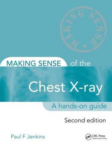 Cover image for Making Sense of the Chest X-ray: A hands-on guide