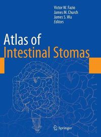 Cover image for Atlas of Intestinal Stomas