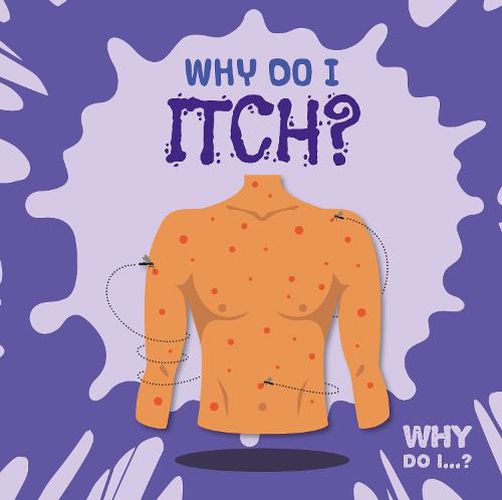 Cover image for Why Do I Itch?