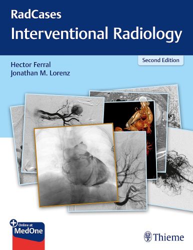 Cover image for RadCases Q&A Interventional Radiology