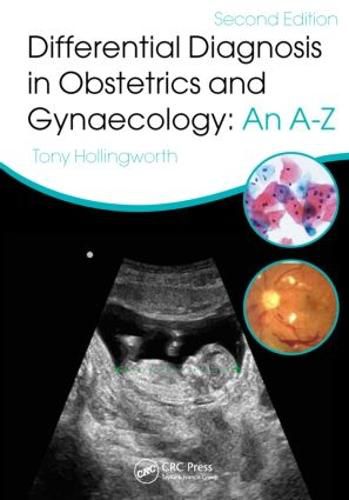 Cover image for Differential Diagnosis in Obstetrics and Gynaecology: An A-Z: An A-Z, Second Edition