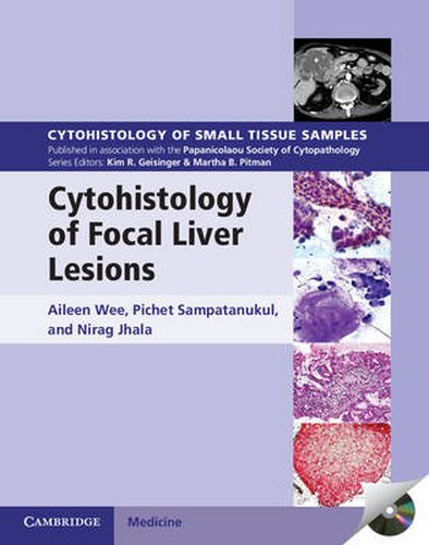 Cover image for Cytohistology of Focal Liver Lesions