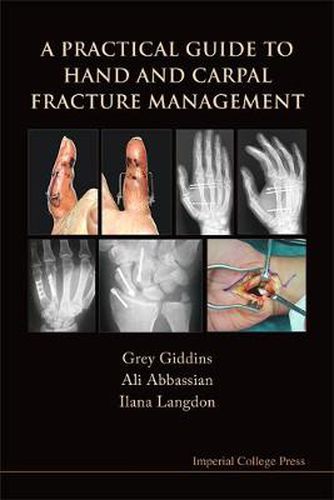 Cover image for Practical Guide To Hand And Carpal Fracture Management, A