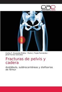 Cover image for Fracturas de pelvis y cadera