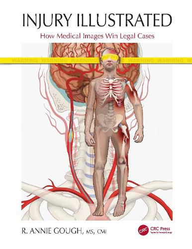 Cover image for Injury Illustrated: How Medical Images Win Legal Cases