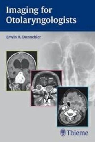 Cover image for Imaging for Otolaryngologists