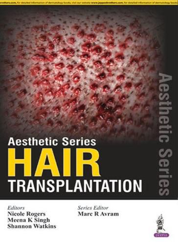 Cover image for Aesthetic Series - Hair Transplantation