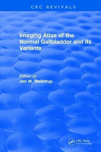 Cover image for Imaging Atlas: Of The Normal Gallbladder and Its Variants