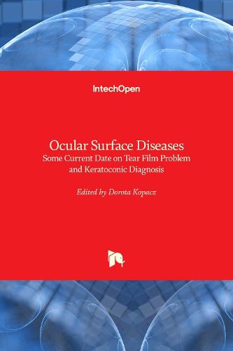 Cover image for Ocular Surface Diseases: Some Current Date on Tear Film Problem and Keratoconic Diagnosis