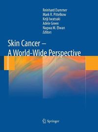 Cover image for Skin Cancer - A World-Wide Perspective