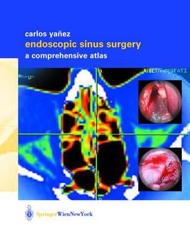 Cover image for Endoscopic Sinus Surgery: A Comprehensive Atlas