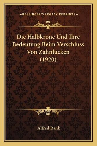 Cover image for Die Halbkrone Und Ihre Bedeutung Beim Verschluss Von Zahnlucken (1920)