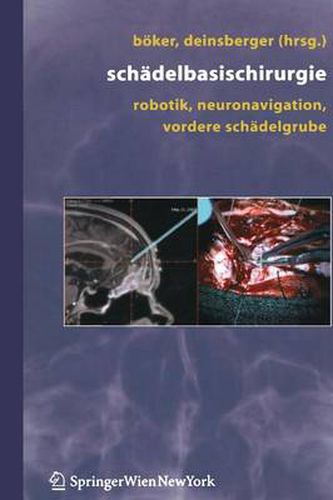 Cover image for Schadelbasischirurgie: Robotik, Neuronavigation, Vordere Schadelgrube