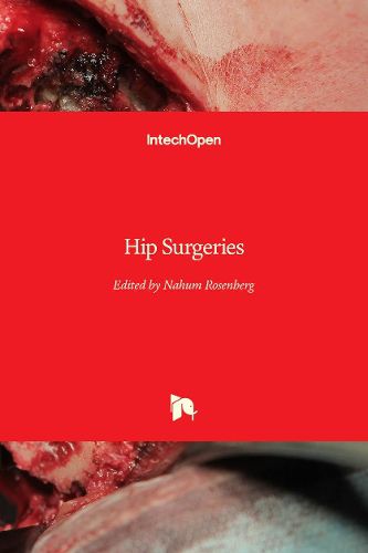 Cover image for Hip Surgeries