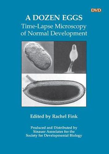 Cover image for A Dozen Eggs: Time-Lapse Microscopy of Normal Development