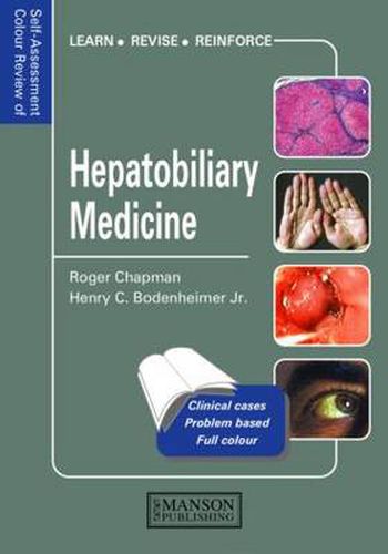 Cover image for Hepatobiliary Medicine