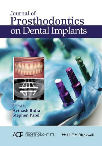 Cover image for Journal of Prosthodontics on Dental Implants