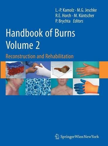 Cover image for Handbook of Burns Volume 2: Reconstruction and Rehabilitation