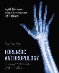 Cover image for Forensic Anthropology