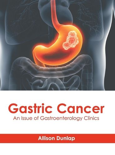 Cover image for Gastric Cancer