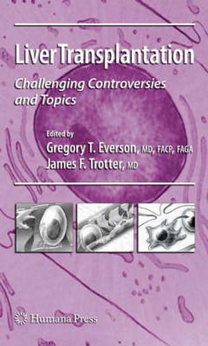 Cover image for Liver Transplantation: Challenging Controversies and Topics