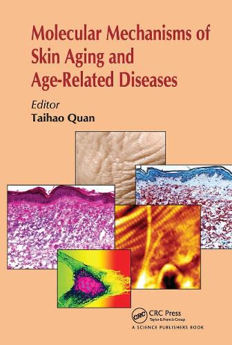 Cover image for Molecular Mechanisms of Skin Aging and Age-Related Diseases