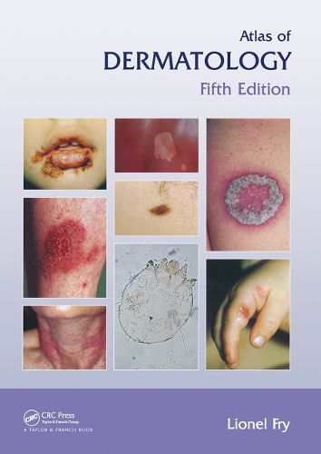 Cover image for Atlas of Dermatology, Fifth Edition