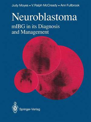 Cover image for Neuroblastoma: mIBG in its Diagnosis and Management