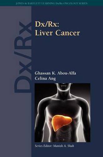 Cover image for Dx/Rx: Liver Cancer: Liver Cancer