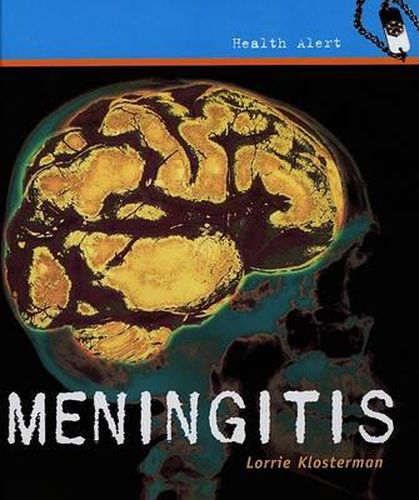 Cover image for Meningitis
