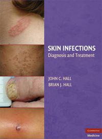 Cover image for Skin Infections: Diagnosis and Treatment