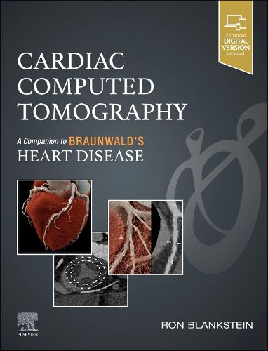 Cover image for Cardiac Computed Tomography